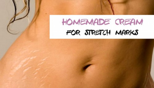 Homemade Cream For Stretch Marks
